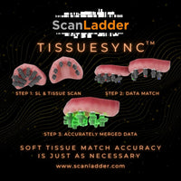 Scan Ladder TissueSync Scanbody Set