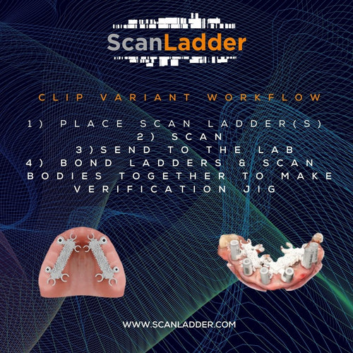 Step Ladder Radiography How It Works – Scan Ladder