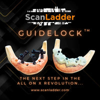 Scan Ladder GuideLock™ System