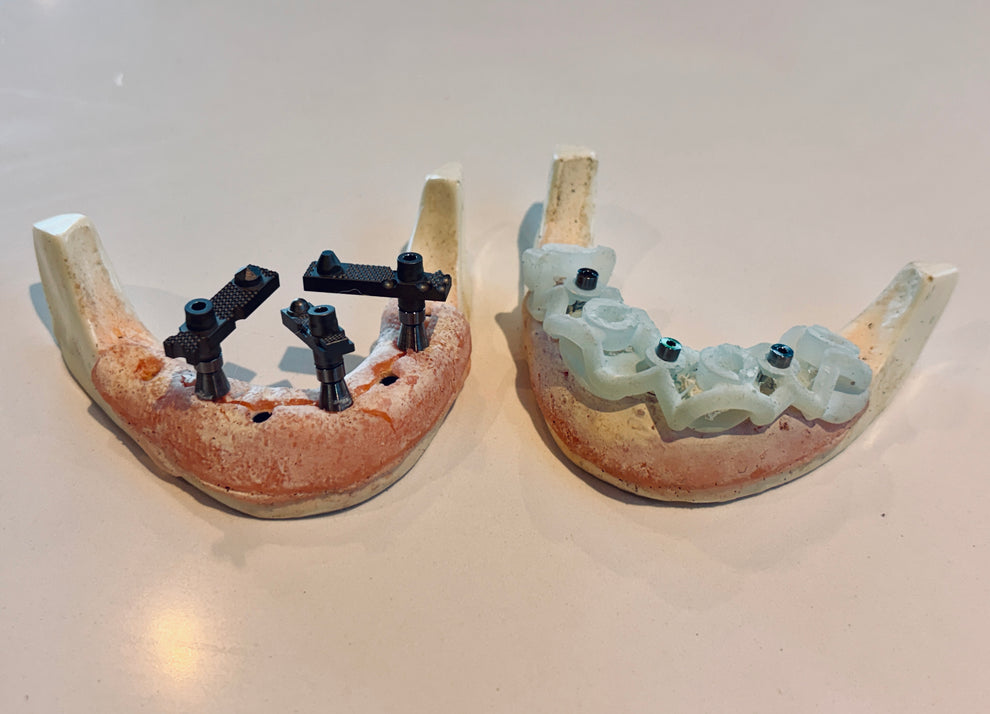 Scan Ladder GuideLock | Guided Implant Surgery Reference System